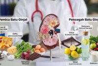 Tak Cuma Kurang Minum, Ternyata 3 Makanan Harian Ini Jadi Pemicu Batu Ginjal (Foto: Getty Images/Nadzeya Haroshka/detikHealth/Ai)