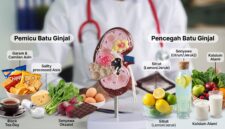 Tak Cuma Kurang Minum, Ternyata 3 Makanan Harian Ini Jadi Pemicu Batu Ginjal (Foto: Getty Images/Nadzeya Haroshka/detikHealth/Ai)