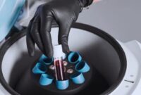 Investasi Takeda Rp539 Miliar Perkuat Industri Plasma RI (Foto: MAGNIFIC/rri)