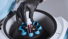 Investasi Takeda Rp539 Miliar Perkuat Industri Plasma RI (Foto: MAGNIFIC/rri)